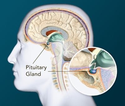 Pituitary-Tumors