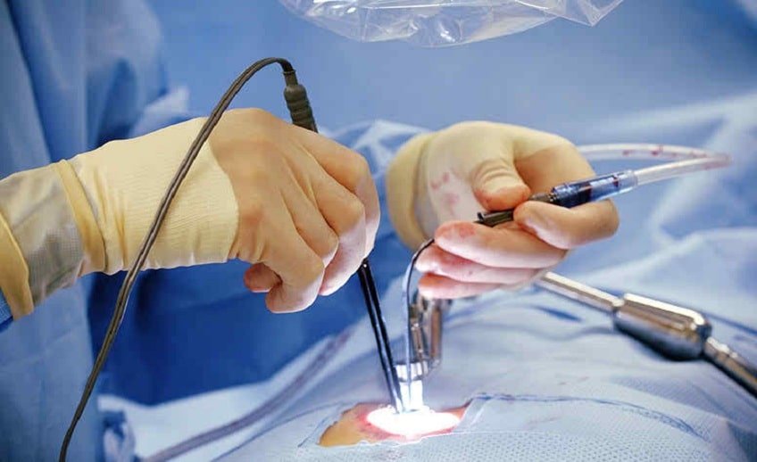 endoscopic-spine-surgery