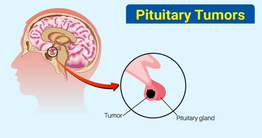 What is a Pituitary Tumor Is Pituitary Tumor Dangerous