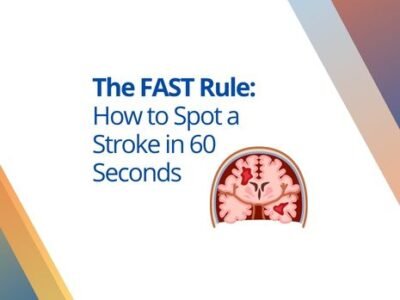 brain stroke FAST