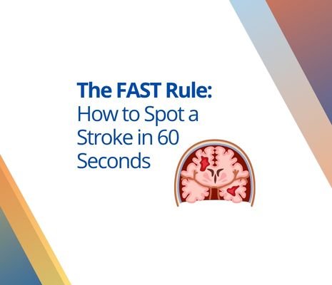 brain stroke FAST