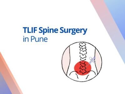 tlif spine surgery
