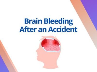 Brain Bleeding After an Accident