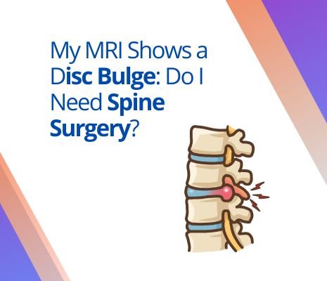 My MRI Shows a Disc Bulge: Do I Need Spine Surgery?