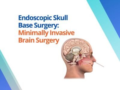 Endoscopic Skull Base Surgery: Minimally Invasive Brain Surgery